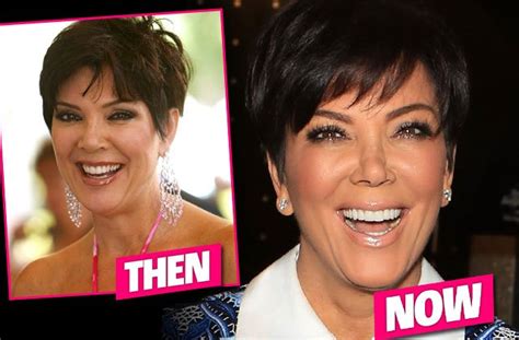 Kris Jenners Before And After Plastic Surgery Photos Show She Looks