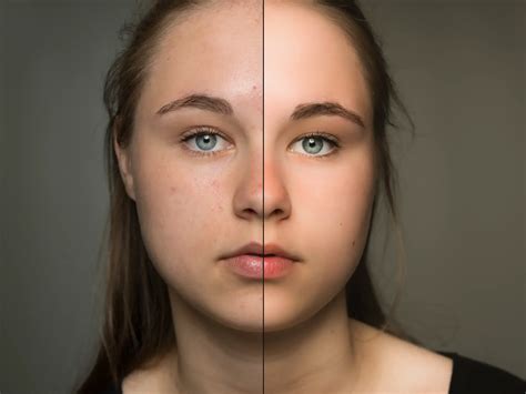 how to whitening the skin naturally 3