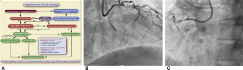 A Algorithm Of Chronic Total Occlusion Crossing B Dual Injection Download Scientific