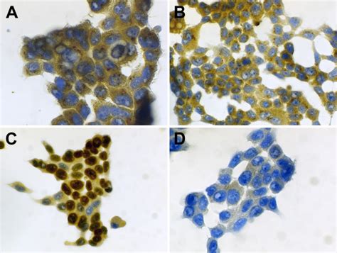 S100a7psoriasin Is Expressed In Small Perinuclear Granules