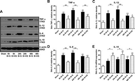 Western Blot Analysis Of Inflammatory Cytokines In Wound Interspaces