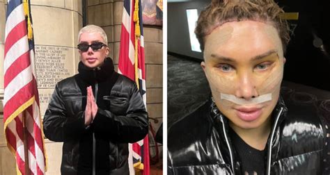 Oli London Detransitions From Korean Woman To British Man