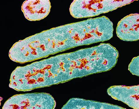 Haemophilus Influenzae Bacteria Photograph By Cnri