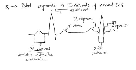 Interpret The Components Of A Normal Ecg Pattern With A Time Scale By Clicking And Dragging The