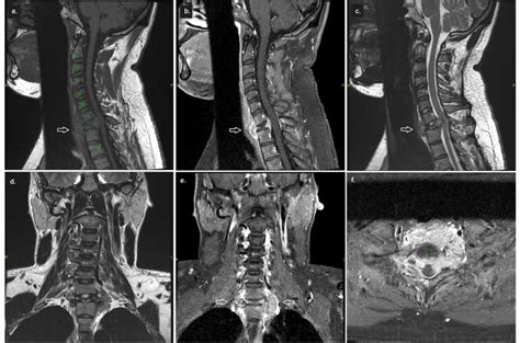 Multi Sequential Multiplanar Magnetic Resonance Imaging Of The