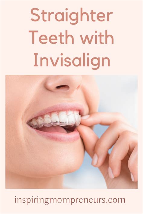 Patients Can Have Straighter Teeth With Invisalign