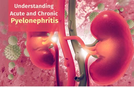 Understanding Acute and Chronic Pyelonephritis - Kundan Kidney Care Centre