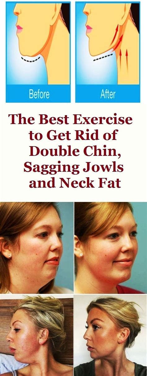 How To Get Rid Of Fat From Face And Neck Online