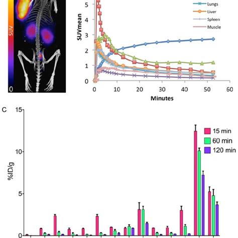 A Representative D Mip Reconstruction Of Ga Dotatoc Pet Ct Of