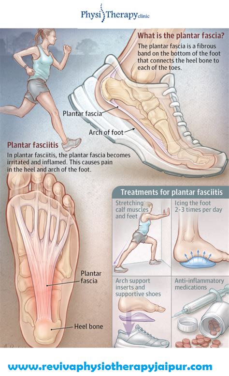 Understanding Foot Types And Managing The Adolescent Athlete Artofit