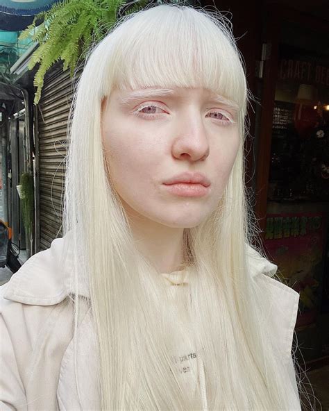 Fringe Bangs Short Fringe Albino Girl Site Model Internet Girl Albinism Only Girl White