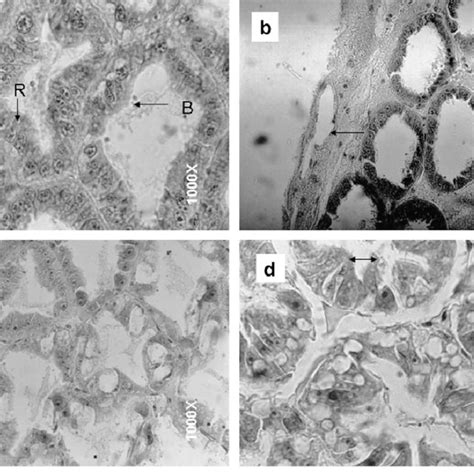 Histological Observations Of Hepatopancreas From White Shrimp Exposed Download Scientific