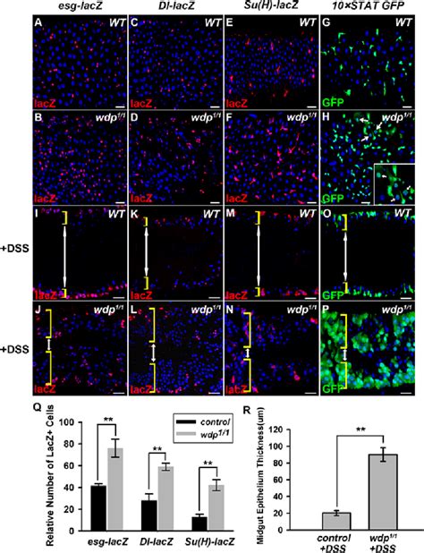 Figure From Windpipe Controls Drosophila Intestinal Homeostasis By