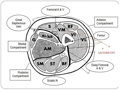 Acute compartment syndrome