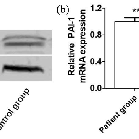 Comparison Of Cd P Mrna Expressions In Pbmcs Between Two Groups A