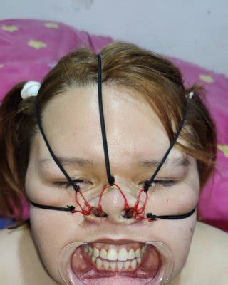 Face Bondage Nose Hook Porn Pictures Xxx Photos Sex Images Pictoa