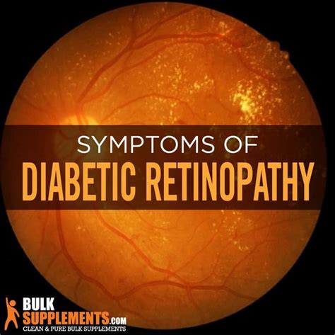 Diabetic Retinopathy Causes Symptoms And Treatment