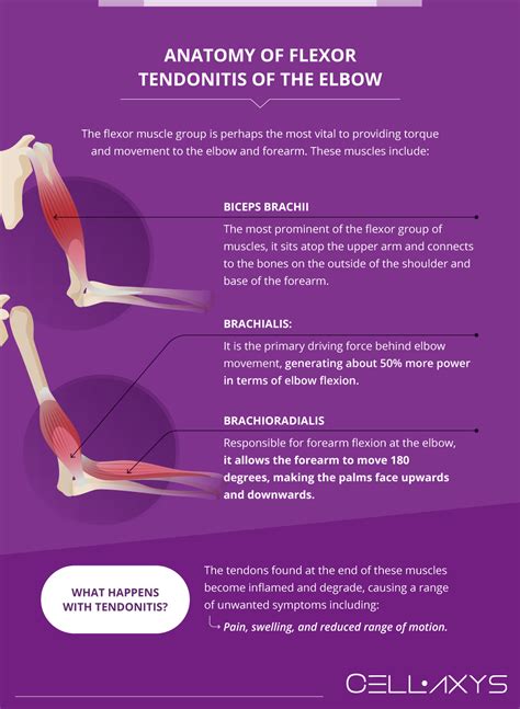 Flexor Tendonitis Of The Elbow Anatomy Symptoms Causes And Treatments