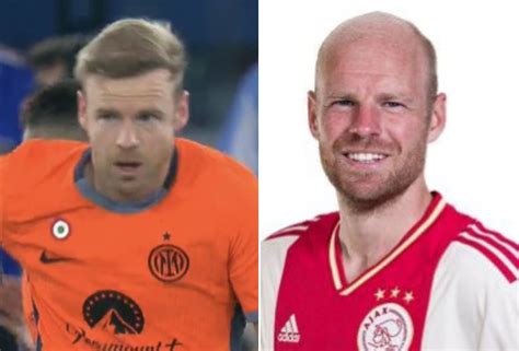 Davy Klaassen Becomes Footballs Latest Hair Transplant Success Story