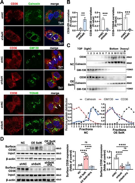 SelK Mediates The Subcellular Localization Of CD36 On Day 0 HepG2