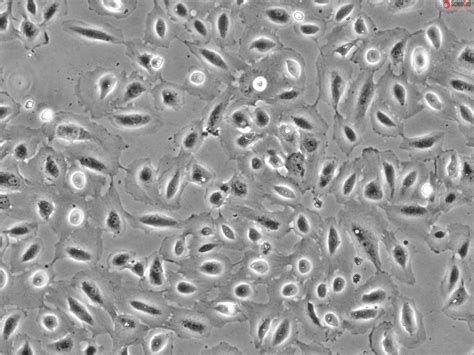 Human Amniotic Epithelial Cells