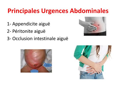 Solution Principaux Syndromes Digestifs Principales Urgences