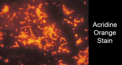 Acridine Orange Stain- Principle, Procedure and Result Interpretation
