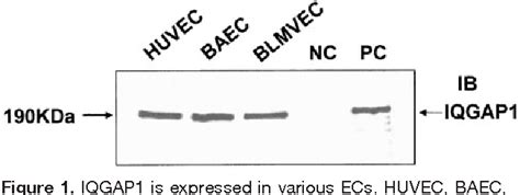 Figure 1 From IQGAP1 A Novel Vascular Endothelial Growth Factor