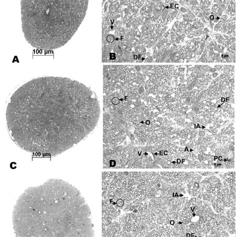 Photomicrographs Of Optic Nerve Cross Sections In Control A B Anemic