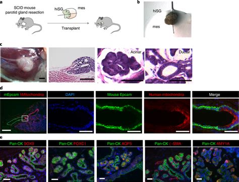 Orthotopic Transplantation Of Human Salivary Gland Organoids A