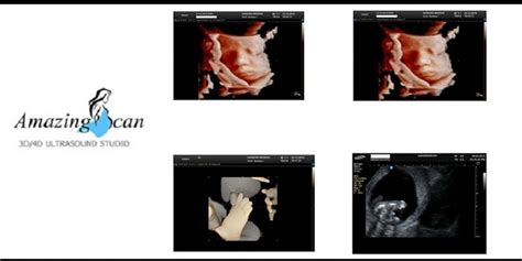 How Important Is 3d 4d Ultrasound During Pregnancy