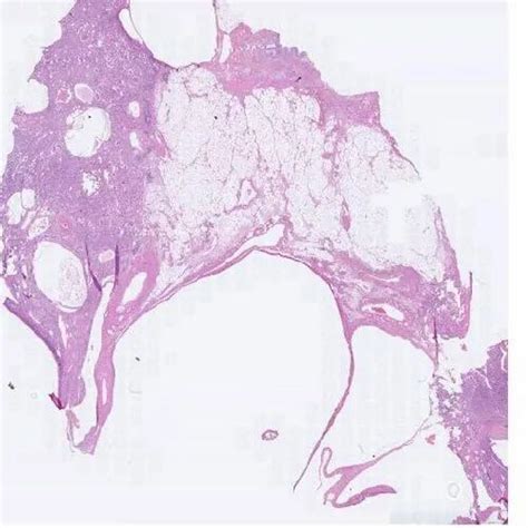 Pathology Slides At Rs 600 In Noida Id 21250728512