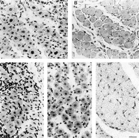 In Situ Hybridization Using Antisense Ac E And Sense B Riboprobes