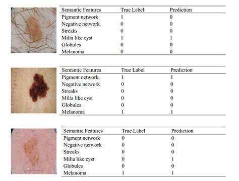 An Interpretable Hierarchical Semantic Convolutional Neural Network To