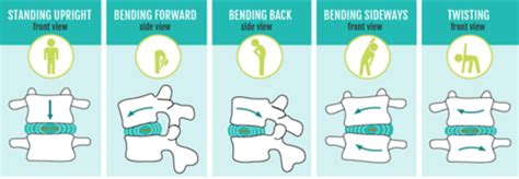 Agents and Modalities Exam 2 (Traction) Flashcards | Quizlet 