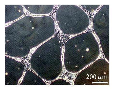 Characteristic Of Endothelial Progenitor Cells EPCs A