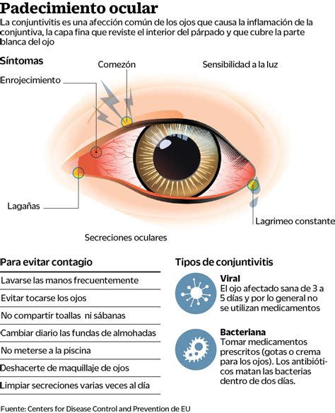 Suben casos de conjuntivitis viral El Siglo de Torreón