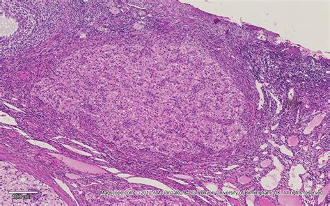 Low magnification image of a corpus luteum