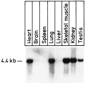 Northern Blot Analysis Of Mvap Mrna Poly A Rna Isolated From The