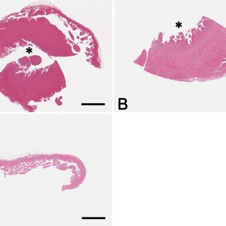 Photomicrographs Of Sections Of The Heart Of An Age Matched Normal