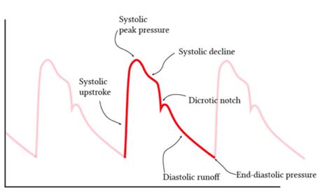 Hemodynamic Monitoring Flashcards Quizlet