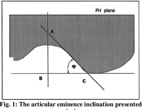 articular eminence