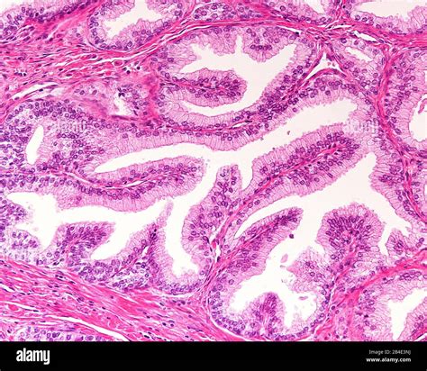 Glandula alveolar simple histologia fotografías e imágenes de alta