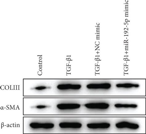 Mir P Inhibits The Fibrosis In Tgf Stimulated Tendon Cells A