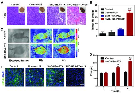 Sno Hsa Ptx Combined With Us Irradiation Enhanced Tumor Hemorrhage And Download Scientific