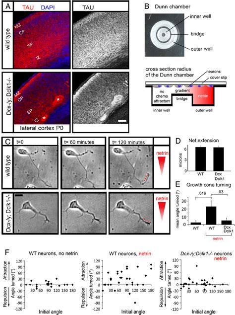 Axonal growth cones from Dcx Ϫ y Dclk1 Ϫ Ϫ cortical neurons are