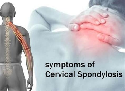 Spine Specialist Surgeon In Pune