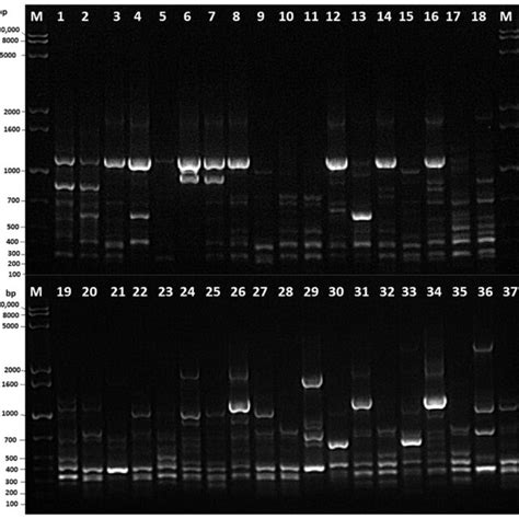 Representative Gel Electrophoresis Of Eric Pcr Using Eric Primer Lane