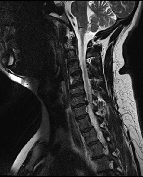 Head And Neck Simplemed Learning Medicine Simplified