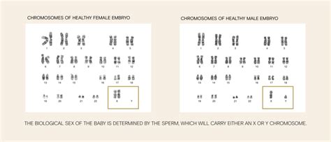 Can You Choose The Sex Of Your Baby Give Legacy